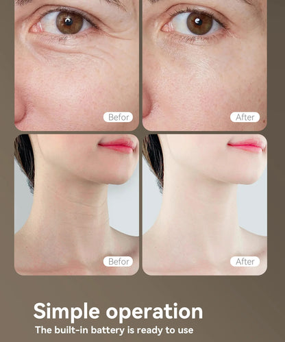 Therapy Mask Face Neck with Red Light Rechargeable LED